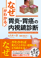 「なぜ」がわかる！胃炎・胃癌の内視鏡診断