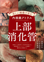 美しい画像で見る内視鏡アトラス　上部消化管