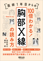 医師1年目からの　100倍わかる！　胸部X線の読み方