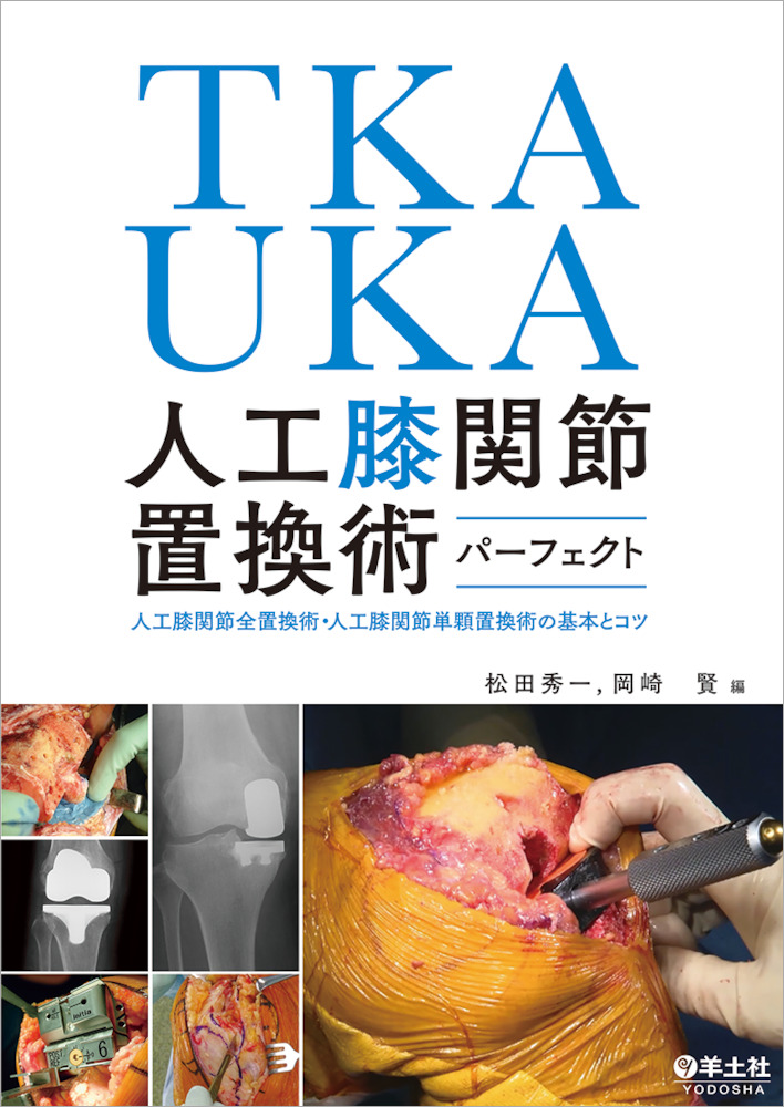 TKAUKA 人工膝関節置換術　パーフェクト
