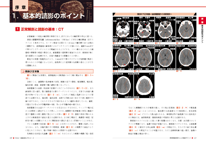できる！画像診断入門シリーズ：頭部画像診断のここが鑑別ポイント 