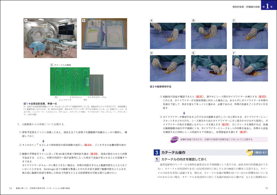 動画で身につく肝疾患の基本手技―インターベンション治療の秘訣