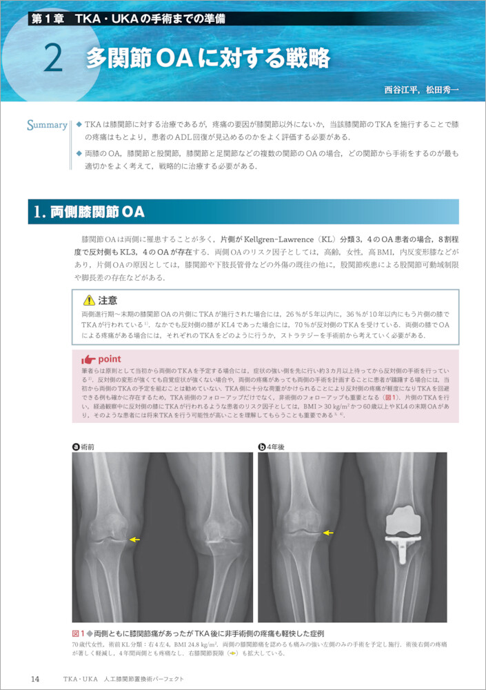 手技と論点　人工膝関節置換術　高質　健康/医学