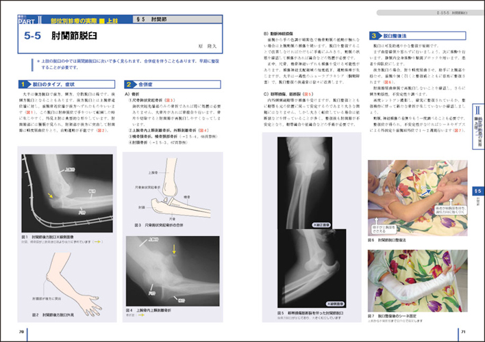 ビジュアル基本手技シリーズ：カラー写真でみる！ 骨折・脱臼・捻挫〜画像診断の進め方と整復・固定のコツ - 羊土社