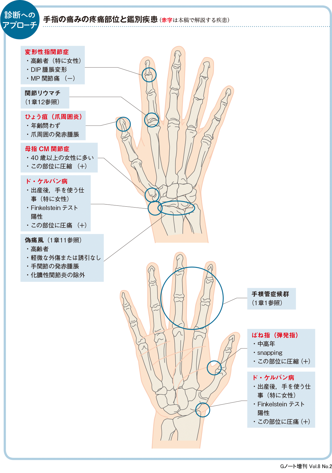 手関節・手指の手術